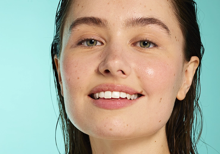 Soins anti-imperfections